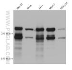DSP Antibody in Western Blot (WB)