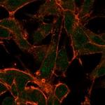 MED22 (Transcription Factor) Monoclonal Antibody (PCRP-MED22-2A7)