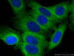 DICER1 Antibody in Immunocytochemistry (ICC/IF)