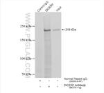 DICER1 Antibody in Immunoprecipitation (IP)