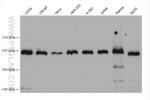 DICER1 Antibody in Western Blot (WB)
