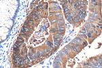 CEA Antibody in Immunohistochemistry (Paraffin) (IHC (P))