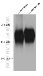 CEA Antibody in Western Blot (WB)
