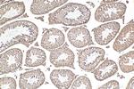 LBR Antibody in Immunohistochemistry (Paraffin) (IHC (P))