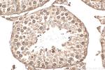 LBR Antibody in Immunohistochemistry (Paraffin) (IHC (P))