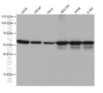 LBR Antibody in Western Blot (WB)