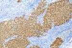 UGP2 Antibody in Immunohistochemistry (Paraffin) (IHC (P))