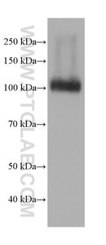 DPP4/CD26 Antibody in Western Blot (WB)
