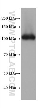 DPP4/CD26 Antibody in Western Blot (WB)