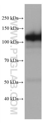 DPP4/CD26 Antibody in Western Blot (WB)