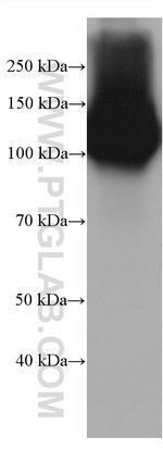 DPP4/CD26 Antibody in Western Blot (WB)