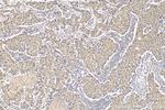 FOXC2 Antibody in Immunohistochemistry (Paraffin) (IHC (P))