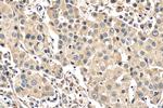 FOXC2 Antibody in Immunohistochemistry (Paraffin) (IHC (P))