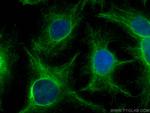 PFKL Antibody in Immunocytochemistry (ICC/IF)