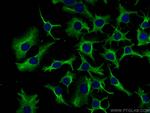 PFKL Antibody in Immunocytochemistry (ICC/IF)