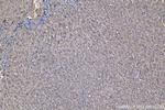 PFKL Antibody in Immunohistochemistry (Paraffin) (IHC (P))