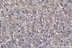 PFKL Antibody in Immunohistochemistry (Paraffin) (IHC (P))