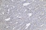 PFKL Antibody in Immunohistochemistry (Paraffin) (IHC (P))