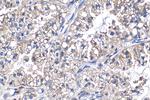 PFKL Antibody in Immunohistochemistry (Paraffin) (IHC (P))