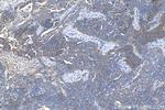 PFKL Antibody in Immunohistochemistry (Paraffin) (IHC (P))
