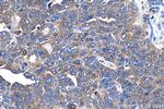 PFKL Antibody in Immunohistochemistry (Paraffin) (IHC (P))