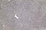 PFKL Antibody in Immunohistochemistry (Paraffin) (IHC (P))