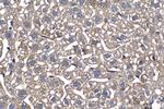 PFKL Antibody in Immunohistochemistry (Paraffin) (IHC (P))