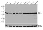 PFKL Antibody in Western Blot (WB)