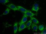 SNX27 Antibody in Immunocytochemistry (ICC/IF)