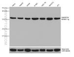 ANKRD54 Antibody in Western Blot (WB)