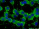 RAB33A Antibody in Immunocytochemistry (ICC/IF)