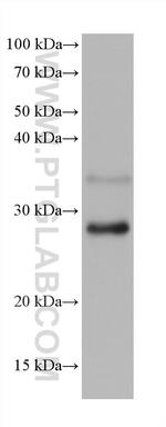 RAB33A Antibody in Western Blot (WB)