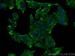 HDDC2 Antibody in Immunocytochemistry (ICC/IF)