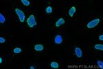 Histone H2B Antibody in Immunocytochemistry (ICC/IF)