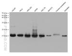 Histone H2B Antibody in Western Blot (WB)