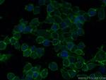 Beta-2-Microglobulin Antibody in Immunocytochemistry (ICC/IF)