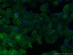 Beta-2-Microglobulin Antibody in Immunocytochemistry (ICC/IF)