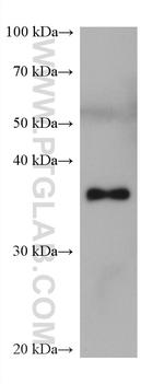 ALDOB Antibody in Western Blot (WB)