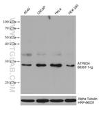 ATPBD4 Antibody in Western Blot (WB)
