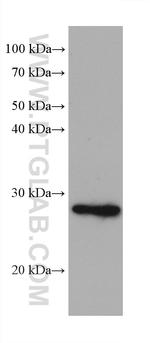 ATPBD4 Antibody in Western Blot (WB)