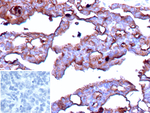 BST2/Tetherin/CD317 (Target for Tumor Immunotherapy) Recombinant Rabbit Monoclonal Antibody (BST2/13681R)