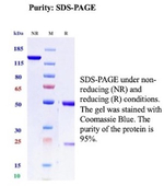 BST2/Tetherin/CD317 (Target for Tumor Immunotherapy) Antibody in SDS-PAGE (SDS-PAGE)