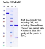 BST2/Tetherin/CD317 (Target for Tumor Immunotherapy) Antibody in SDS-PAGE (SDS-PAGE)