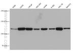 HIP1R Antibody in Western Blot (WB)