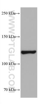 HIP1R Antibody in Western Blot (WB)