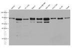 NPHP5/IQCB1 Antibody in Western Blot (WB)