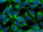 GATC Antibody in Immunocytochemistry (ICC/IF)