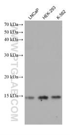 GATC Antibody in Western Blot (WB)