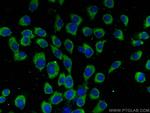 CHMP7 Antibody in Immunocytochemistry (ICC/IF)