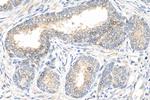 CHMP7 Antibody in Immunohistochemistry (Paraffin) (IHC (P))